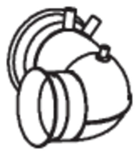 Tranzparts - Dinex PIPE FOR DAF